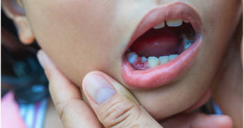 When Do Kids Start Losing Baby Teeth? Your Questions, Answered Losing Baby Teeth