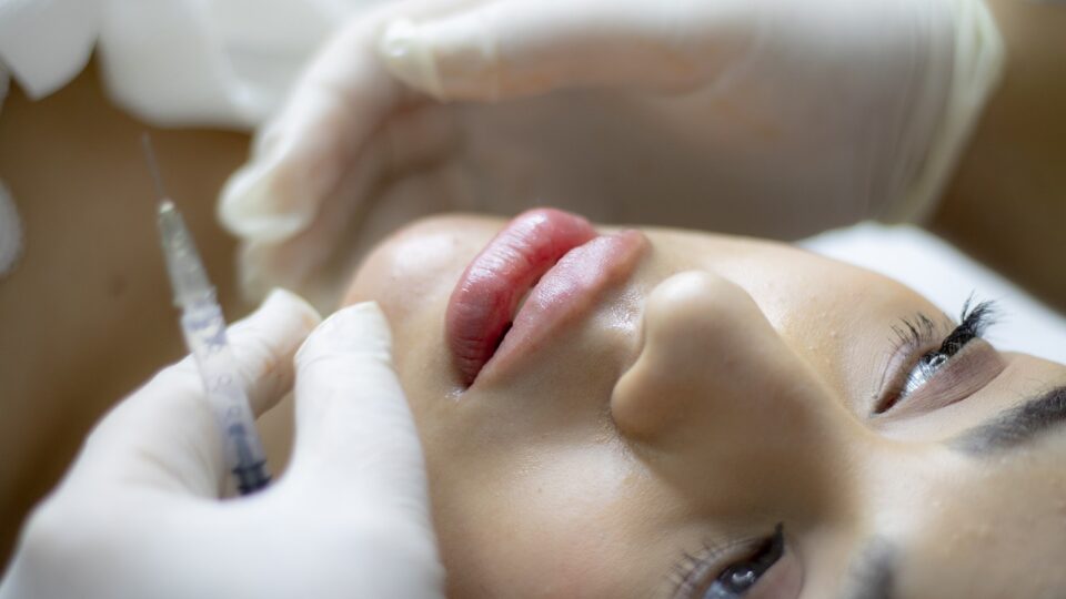 Lip Filler Treatment in Melbourne Orangemarigolds